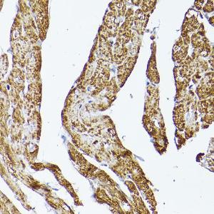 Immunohistochemistry analysis of paraffin-embedded rat heart using Anti-VDAC2 Antibody (A307060) at a dilution of 1:100 (40x lens). Perform high pressure antigen retrieval with 10 mM citrate buffer pH 6.0 before commencing with IHC staining protocol