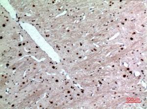 Immunohistochemical analysis of paraffin-embedded rat brain using Anti-KRT14 Antibody