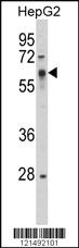 Anti-SRC Rabbit Polyclonal Antibody