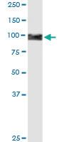 Anti-PLOD2 Rabbit Polyclonal Antibody