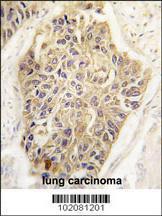 Anti-MAGEA1 Rabbit Polyclonal Antibody (FITC (Fluorescein))