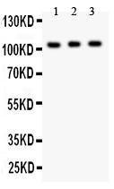 Anti-GRIK1 Polyclonal Antibody