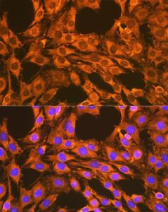 Immunofluorescence analysis of C6 cells using Anti-VDAC2 Antibody (A307060) at a dilution of 1:100 (40x lens). DAPI was used to stain the cell nuclei (blue)