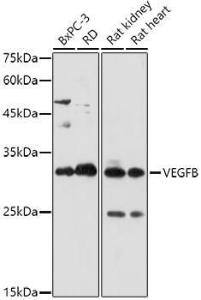 Anti-VEGFB Rabbit Polyclonal Antibody