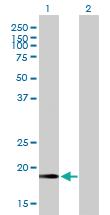 Anti-CETN2 Mouse Polyclonal Antibody