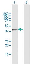 Anti-AACS Rabbit Polyclonal Antibody