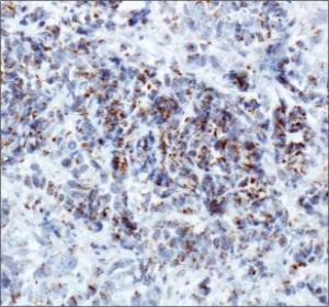 Anti-KDM5B Rabbit Polyclonal Antibody (DyLight® 550)