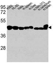 Anti-ACTB Mouse Monoclonal Antibody (AP (Alkaline Phosphatase)) [clone: 137CT26.1.1]