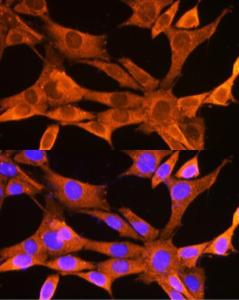 Immunofluorescence analysis of NIH-3T3 cells using Anti-VDAC2 Antibody (A307060) at a dilution of 1:100 (40x lens). DAPI was used to stain the cell nuclei (blue)