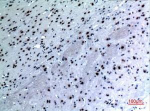 Immunohistochemical analysis of paraffin-embedded rat brain using Anti-KRT14 Antibody