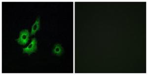 Anti-OR4D1 antibody