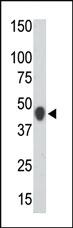 Anti-CKMT2 Rabbit Polyclonal Antibody