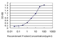 Anti-CETN2 Mouse Monoclonal Antibody [clone: 3F8]