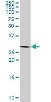 Anti-PLP1 Rabbit Polyclonal Antibody