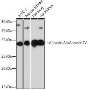 Anti-Annexin-4 / ANXA4 Rabbit Monoclonal Antibody [clone: ARC1477]