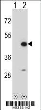 Anti-CKMT2 Rabbit Polyclonal Antibody