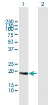 Anti-CETN3 Mouse Polyclonal Antibody