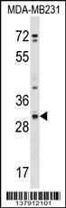 Anti-CRISP1 Rabbit Polyclonal Antibody (AP (Alkaline Phosphatase))