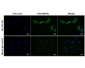 Immunofluorescence analysis of TrkA expression on human SHSY-5Y cell membrane (non-permeabilized cells). Cells were fixed with 4% formaldehyde. Magnification: 100x.