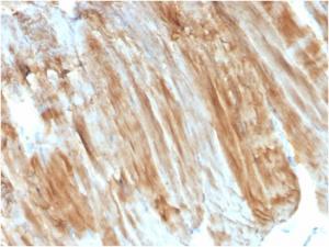 Immunohistochemical analysis of formalin-fixed, paraffin-embedded human skeletal muscle using Anti-Dystrophin Antibody [DMD/3243]