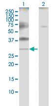 Anti-PLP1 Rabbit Polyclonal Antibody