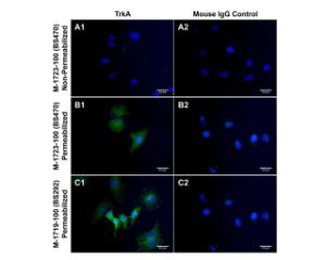 TrkA expression in SHSY-5Y cells, comparing TrkA antibodies M-1723-100 (extracellular domain) and M-1719-100 ( intracellular domain). These cells did not show TrkA expression on  cell membrane (A), while both antibodies were immunoreactive for intracellulary stored TrkA receptor (B and C).