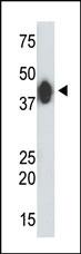 Anti-CKMT2 Rabbit Polyclonal Antibody