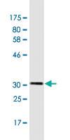 Anti-TRPC1 Mouse Monoclonal Antibody [clone: 1E4]