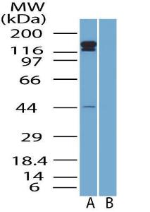 Anti-ERBB2 Rabbit Polyclonal Antibody