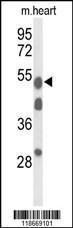 Anti-A1BG Rabbit Polyclonal Antibody