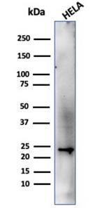 Anti-CBFB Mouse Monoclonal Antibody [Clone: PCRP-CBFB-1F6]