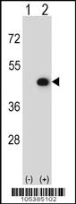 Anti-CKMT2 Rabbit Polyclonal Antibody