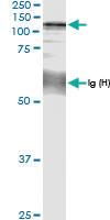 Anti-CC2D1A Rabbit Polyclonal Antibody