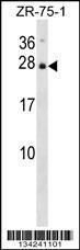 Anti-IL25 Rabbit Polyclonal Antibody (Biotin)