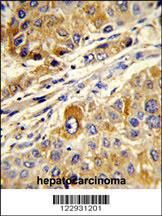 Anti-MASTL Rabbit Polyclonal Antibody (Biotin)