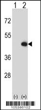 Anti-CKMT2 Rabbit Polyclonal Antibody