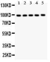 Anti-HCN1 Polyclonal Antibody