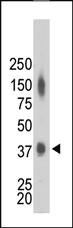 Anti-Creatine Kinase MB (CKM) Rabbit Polyclonal Antibody