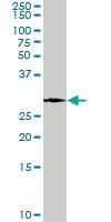 Anti-PLP1 Rabbit Polyclonal Antibody