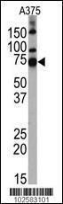 Anti-HDAC10 Rabbit Polyclonal Antibody (HRP (Horseradish Peroxidase))