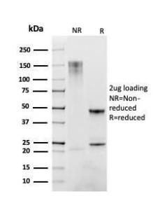 SDS-PAGE analysis of Anti-CD163 Antibody [M130/2163] under non-reduced and reduced conditions; showing intact IgG and intact heavy and light chains, respectively SDS-PAGE analysis confirms the integrity and purity of the antibody