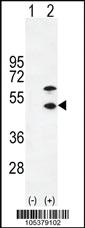 Anti-Creatine Kinase MB (CKM) Rabbit Polyclonal Antibody