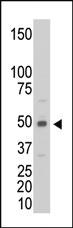 Anti-Creatine Kinase MB (CKM) Rabbit Polyclonal Antibody