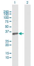 Anti-ITPK1 Rabbit Polyclonal Antibody