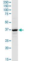 Anti-AACS Rabbit Polyclonal Antibody