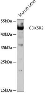 Anti-p39 Rabbit Polyclonal Antibody