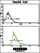 Anti-Creatine Kinase MB (CKM) Rabbit Polyclonal Antibody