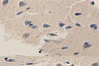 Anti-APP Rabbit Polyclonal Antibody