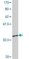 Anti-ZHX1 Mouse Polyclonal Antibody