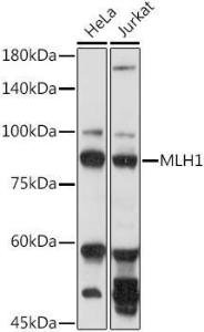 Western blot analysis of extracts of various cell lines, using Anti-mlH1 Antibody (A308154) at 1:1000 dilution